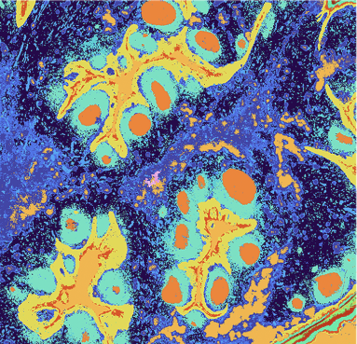 Visium HD Human Tonsil